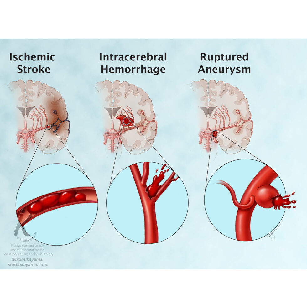 |Studio Kayama| | Medical & Scientific Illustration